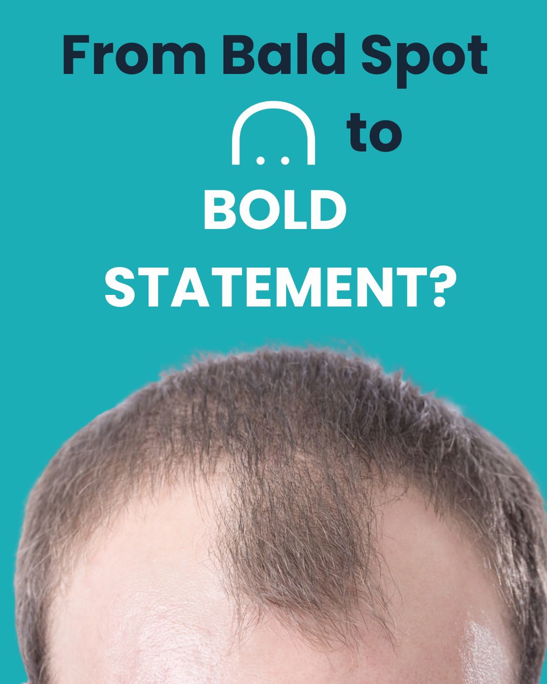 From Bald Spot to Bold Statement: Why More Men Are Choosing the Clean-Shaven Look